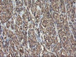 PHF7 Monoclonal Antibody (OTI1G9), TrueMAB , OriGene 100 &mu;L; Unconjugated:Antibodies,
