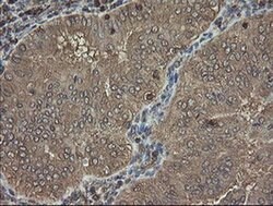 PHF7 Monoclonal Antibody (OTI1G9), TrueMAB , OriGene 100 &mu;L; Unconjugated:Antibodies,