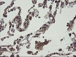 PHF7 Monoclonal Antibody (OTI1G9), TrueMAB , OriGene:Antibodies:Primary