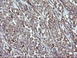 PHF7 Monoclonal Antibody (OTI1A2), TrueMAB , OriGene 30 &mu;L; Unconjugated:Antibodies,