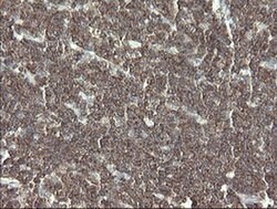 PHF7 Monoclonal Antibody (OTI1A2), TrueMAB , OriGene 30 &mu;L; Unconjugated:Antibodies,