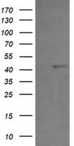 PHF7 Monoclonal Antibody (OTI1A2), TrueMAB , OriGene 30 &mu;L; Unconjugated:Antibodies,
