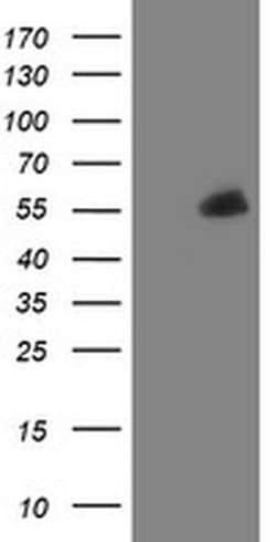 PHF7 Monoclonal Antibody (OTI1B4), TrueMAB , OriGene:Antibodies:Primary