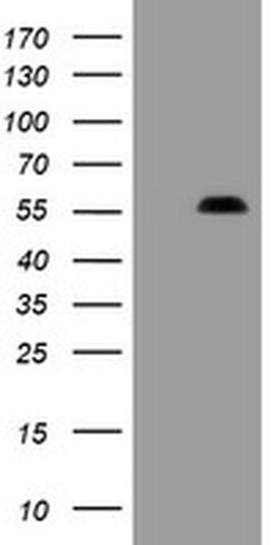 PHF7 Monoclonal Antibody (OTI1A11), TrueMAB , OriGene 100 &mu;L; Unconjugated:Antibodies,