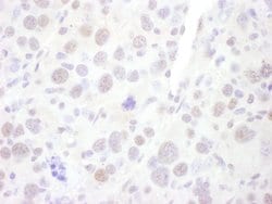 PHF8 Rabbit anti-Human, Mouse, Polyclonal, Bethyl Laboratories 100 &mu;L;