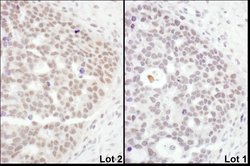 PHF8 Rabbit anti-Human, Mouse, Polyclonal, Bethyl Laboratories 100 &mu;L;