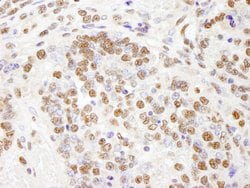 PHF8 Polyclonal Antibody, Bethyl Laboratories:Antibodies:Primary Antibodies