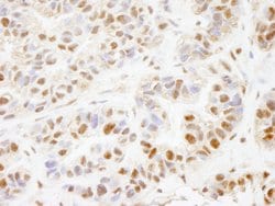 PHF8 Polyclonal Antibody, Bethyl Laboratories 100 &mu;L; Unconjugated:Antibodies,
