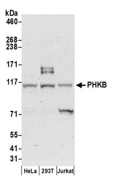 PHKB Polyclonal Antibody, Bethyl Laboratories 20 &mu;L; Unconjugated:Antibodies,