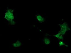 PHKG2 Monoclonal Antibody (OTI2A3), TrueMAB , OriGene 100 &mu;L; Unconjugated:Antibodies,
