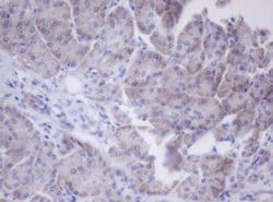 PHKG2 Monoclonal Antibody (OTI2E5), TrueMAB , OriGene:Antibodies:Primary