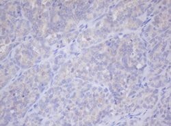 PHKG2 Monoclonal Antibody (OTI2E5), TrueMAB , OriGene:Antibodies:Primary