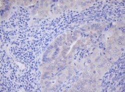PHKG2 Monoclonal Antibody (OTI2E5), TrueMAB , OriGene 100 &mu;L; Unconjugated:Antibodies,