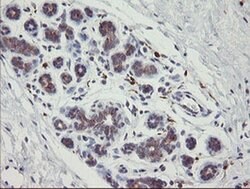 PHKG2 Monoclonal Antibody (OTI1F9), TrueMAB , OriGene 100 &mu;L; Unconjugated:Antibodies,