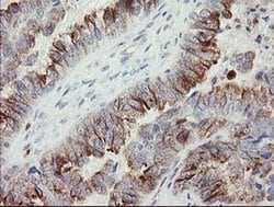 PHKG2 Monoclonal Antibody (OTI1F9), TrueMAB , OriGene:Antibodies:Primary