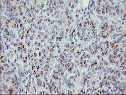 PHKG2 Monoclonal Antibody (OTI1F9), TrueMAB , OriGene 100 &mu;L; Unconjugated:Antibodies,