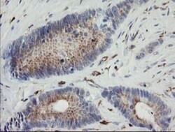 PHKG2 Monoclonal Antibody (OTI1F9), TrueMAB , OriGene 100 &mu;L; Unconjugated:Antibodies,