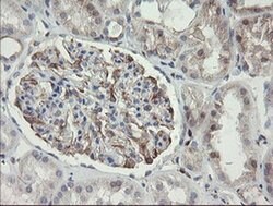 PHKG2 Monoclonal Antibody (OTI1F9), TrueMAB , OriGene:Antibodies:Primary