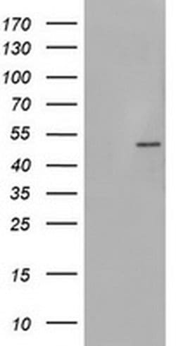 PHKG2 Monoclonal Antibody (OTI2E5), TrueMAB , OriGene 100 &mu;L; Unconjugated:Antibodies,