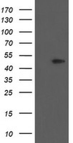 PHKG2 Monoclonal Antibody (OTI2A3), TrueMAB , OriGene 100 &mu;L; Unconjugated:Antibodies,