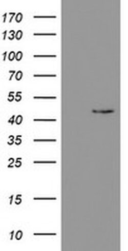 PHKG2 Monoclonal Antibody (OTI1F9), TrueMAB , OriGene 100 &mu;L; Unconjugated:Antibodies,