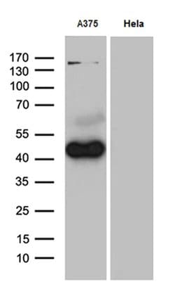 PHLDA1 Monoclonal Antibody (OTI4D9), TrueMAB , OriGene 30 &mu;L; Unconjugated:Antibodies,