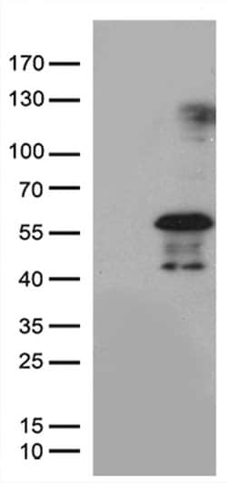 PHLDA1 Monoclonal Antibody (OTI4G2), TrueMAB , OriGene:Antibodies:Primary