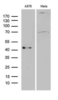 PHLDA1 Monoclonal Antibody (OTI4G2), TrueMAB , OriGene 100 &mu;L; Unconjugated:Antibodies,