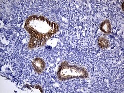 PHYHD1 Monoclonal Antibody (OTI1A6), TrueMAB , OriGene:Antibodies:Primary