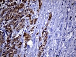 PHYHD1 Monoclonal Antibody (OTI1A6), TrueMAB , OriGene 100 &mu;L; Unconjugated:Antibodies,