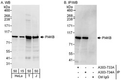PI4KB Rabbit anti-Human, Polyclonal, Bethyl Laboratories 100 &mu;L; Unconjugated:Antibodies,