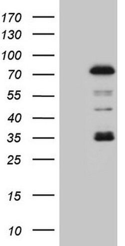PIAS2 Monoclonal Antibody (OTI2B5), TrueMAB , OriGene 100 &mu;L; Unconjugated:Antibodies,