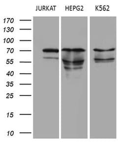 PIAS2 Monoclonal Antibody (OTI5B4), TrueMAB , OriGene:Antibodies:Primary
