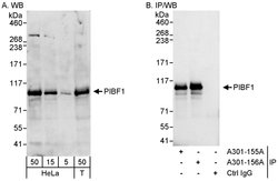PIBF Rabbit anti-Human, Polyclonal, Bethyl Laboratories 100 &mu;l; Unlabeled:Antibodies,