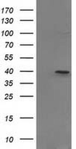 PIH1D2 Monoclonal Antibody (OTI5G9), TrueMAB , OriGene 100 &mu;L; Unconjugated:Antibodies,