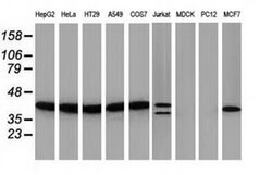 PIH1D2 Monoclonal Antibody (OTI5G9), TrueMAB , OriGene 100 &mu;L; Unconjugated:Antibodies,