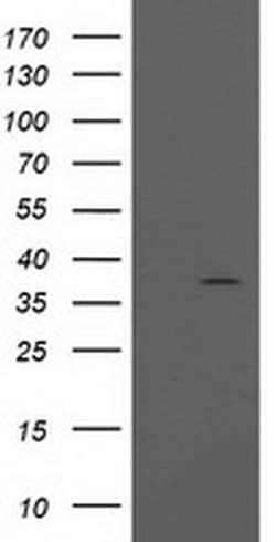 PIH1D2 Monoclonal Antibody (OTI5C12), TrueMAB , OriGene 100 &mu;L; Unconjugated:Antibodies,