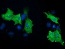 PIK3AP1 Mouse anti-Human, Clone: OTI5A1, lyophilized, TrueMAB 100 &mu;g;