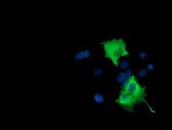 PIK3AP1 Mouse anti-Human, Clone: OTI7A11, lyophilized, TrueMAB 100 &mu;g;