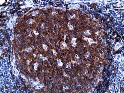 PIK3AP1 Mouse anti-Human, Clone: OTI7A11, lyophilized, TrueMAB 100 &mu;g;