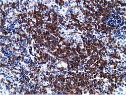 PIK3AP1 Mouse anti-Human, Clone: OTI7A11, lyophilized, TrueMAB 100 &mu;g;