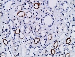 PIK3AP1 Mouse anti-Human, Clone: OTI7A11, lyophilized, TrueMAB 100 &mu;g;