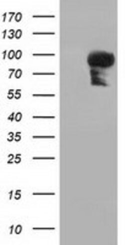 PIK3AP1 Mouse anti-Human, Clone: OTI5A1, lyophilized, TrueMAB 100 &mu;g;