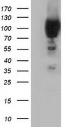 PIK3AP1 Mouse anti-Human, Rat, Clone: OTI6H6, lyophilized, TrueMAB 100