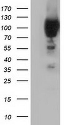 PIK3AP1 Monoclonal Antibody (OTI6H6), TrueMAB , OriGene 30 &mu;L; Unconjugated:Antibodies,