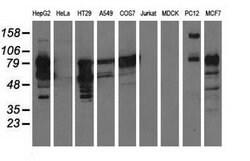 PIK3AP1 Mouse anti-Human, Rat, Clone: OTI6H6, lyophilized, TrueMAB 100