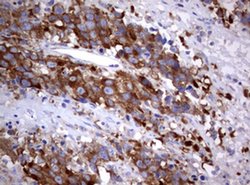 PIK3C2A Monoclonal Antibody (OTI3F8), TrueMAB , OriGene 100 &mu;L; Unconjugated:Antibodies,