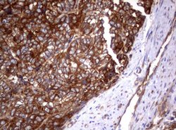 PIK3C2A Monoclonal Antibody (OTI3F8), TrueMAB , OriGene 100 &mu;L; Unconjugated:Antibodies,