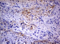 PIK3C2A Mouse anti-Human, Clone: OTI3H2, lyophilized, TrueMAB 100 &mu;g;
