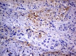 PIK3C2A Monoclonal Antibody (OTI3H2), TrueMAB , OriGene 100 &mu;L; Unconjugated:Antibodies,